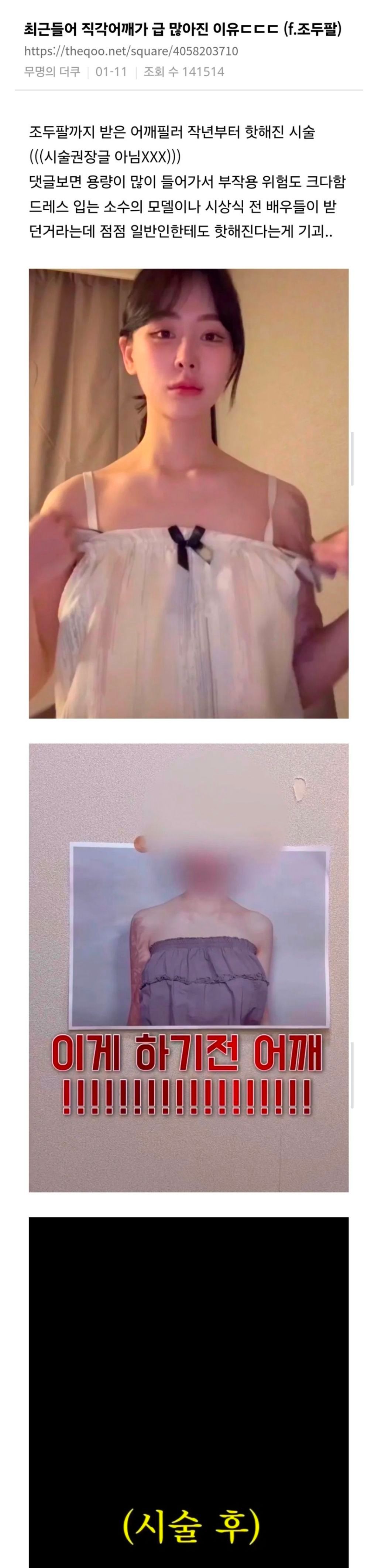 요즘 직각어깨가 급 많아진 이유