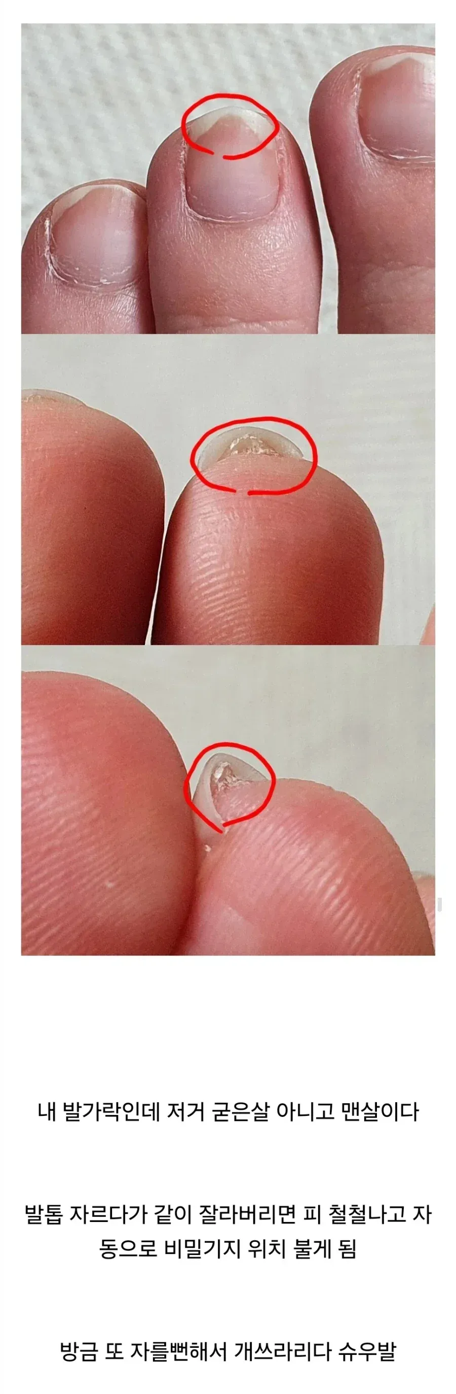 정말 너무하다는 발가락