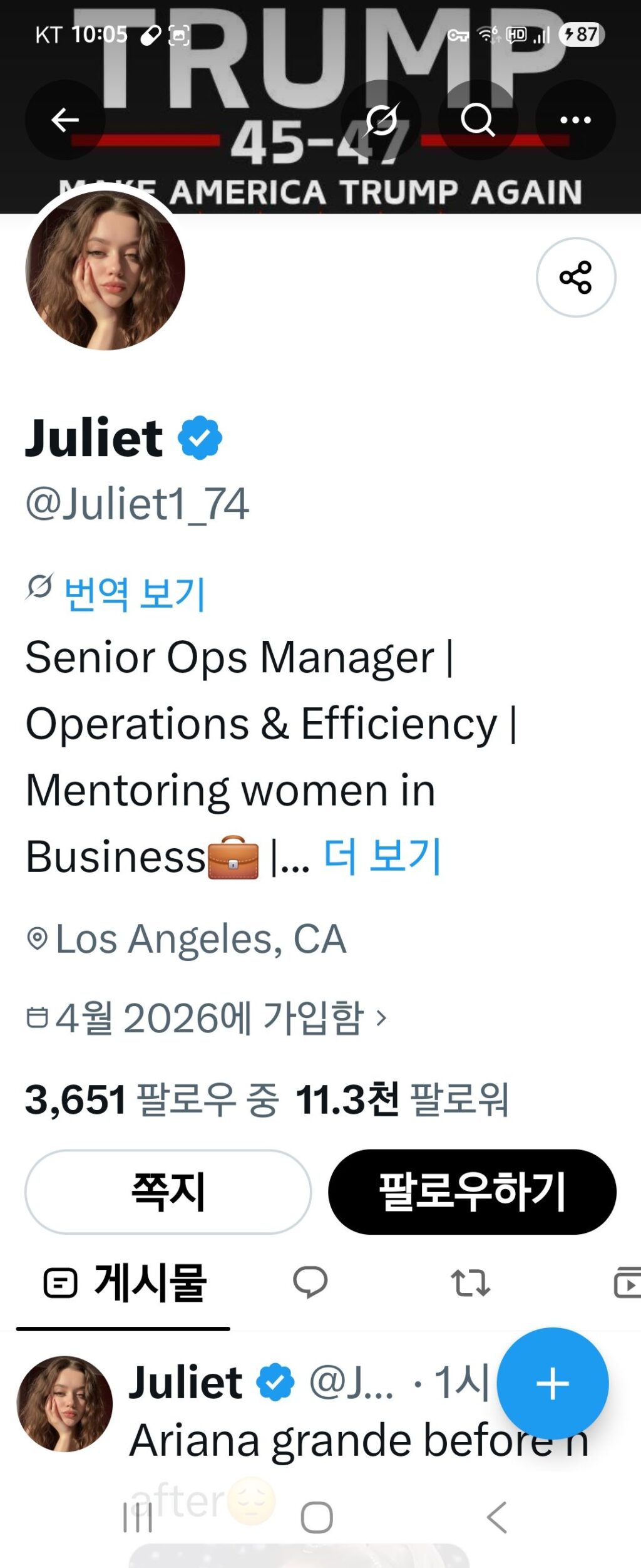 헐리우드 여배우들 성형중독 현재와 과거