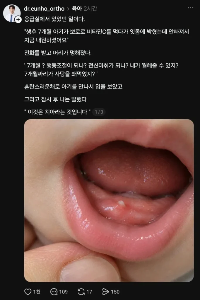 아기 잇몸에 사탕이 박혀 응급실에 감