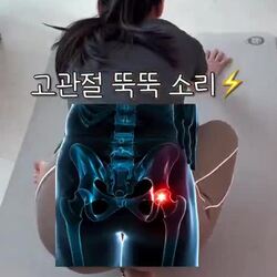고관절 풀어주는 운동